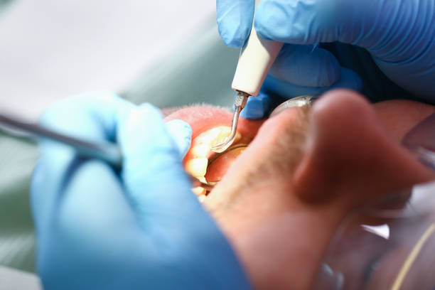 Best Emergency Treatment for Toothache in Cypress Quarters, FL