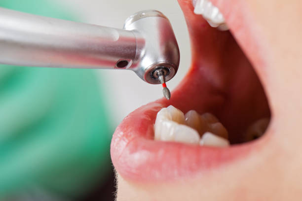 Best Pediatric Emergency Dentist in Cypress Quarters, FL
